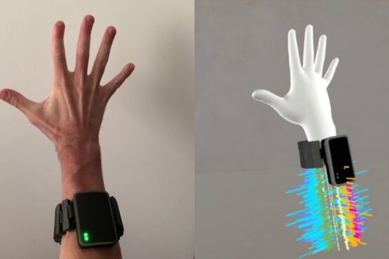 Wristband